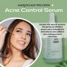 maquillage-wellness-acne-control-face-serum